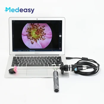 Медицинска преносима ендоскопска камера с Full HD 1080P USB за УНГ